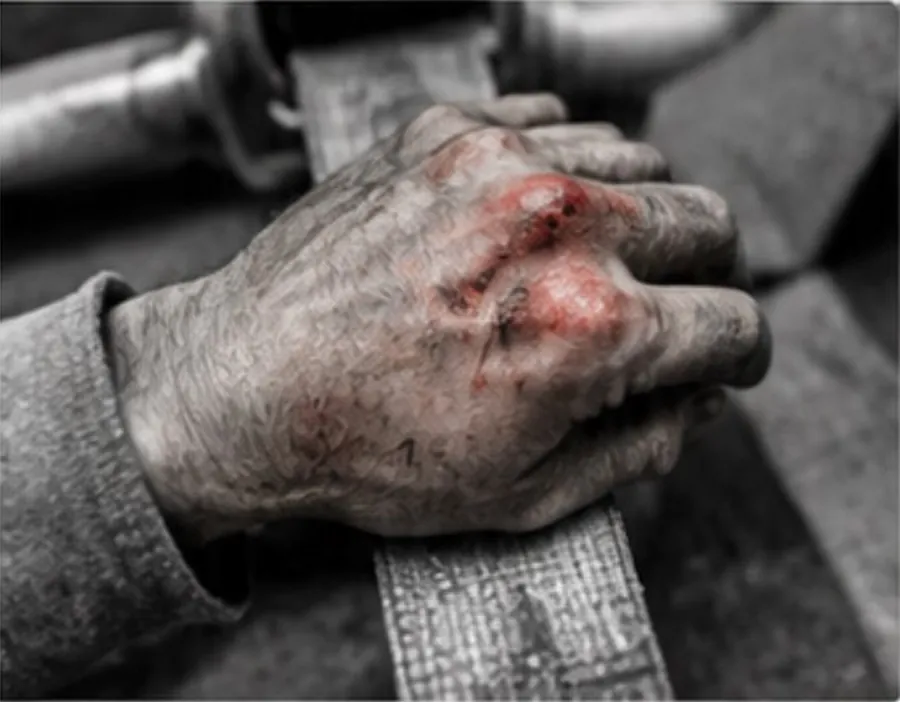 Close-up of a weathered, grimy hand with bloodied knuckles resting on a wooden beam